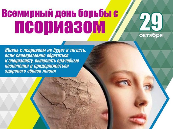 Вилейская ЦРБ 29 октября проведет консультации по вопросам борьбы с псориазом